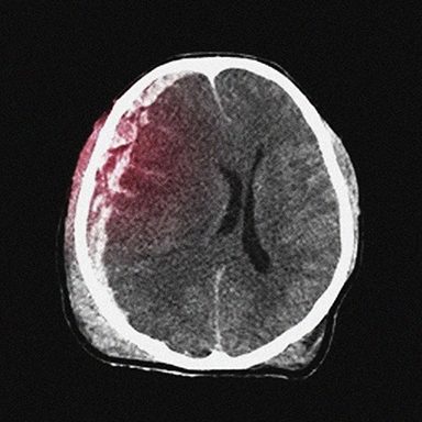 Photo of a Brain Scan